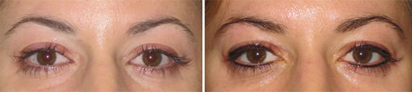 Permanent Makeup Before & After
