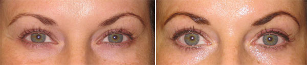 Permanent Makeup Before & After