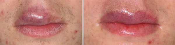 Permanent Makeup Before & After