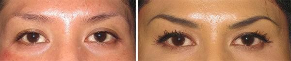 Permanent Makeup Before & After