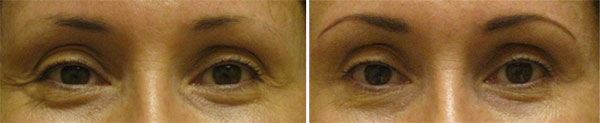 Permanent Makeup Before & After