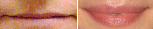 Permanent Makeup Before & After