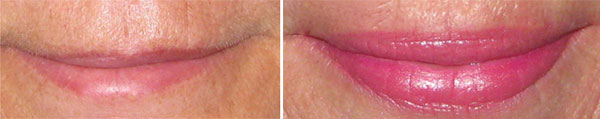 Permanent Makeup Before & After