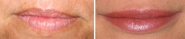 Permanent Makeup Before & After